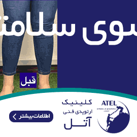 بنر استیکی_فنی آتل